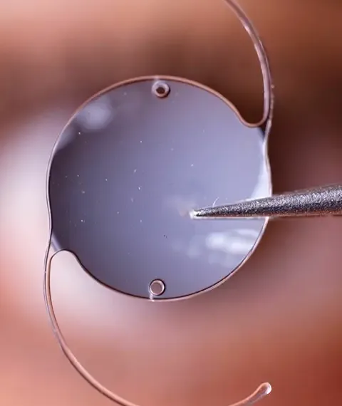 premium IOLs- Saluja Eye care Center