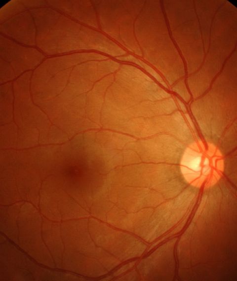 Saluja Eye Care Center